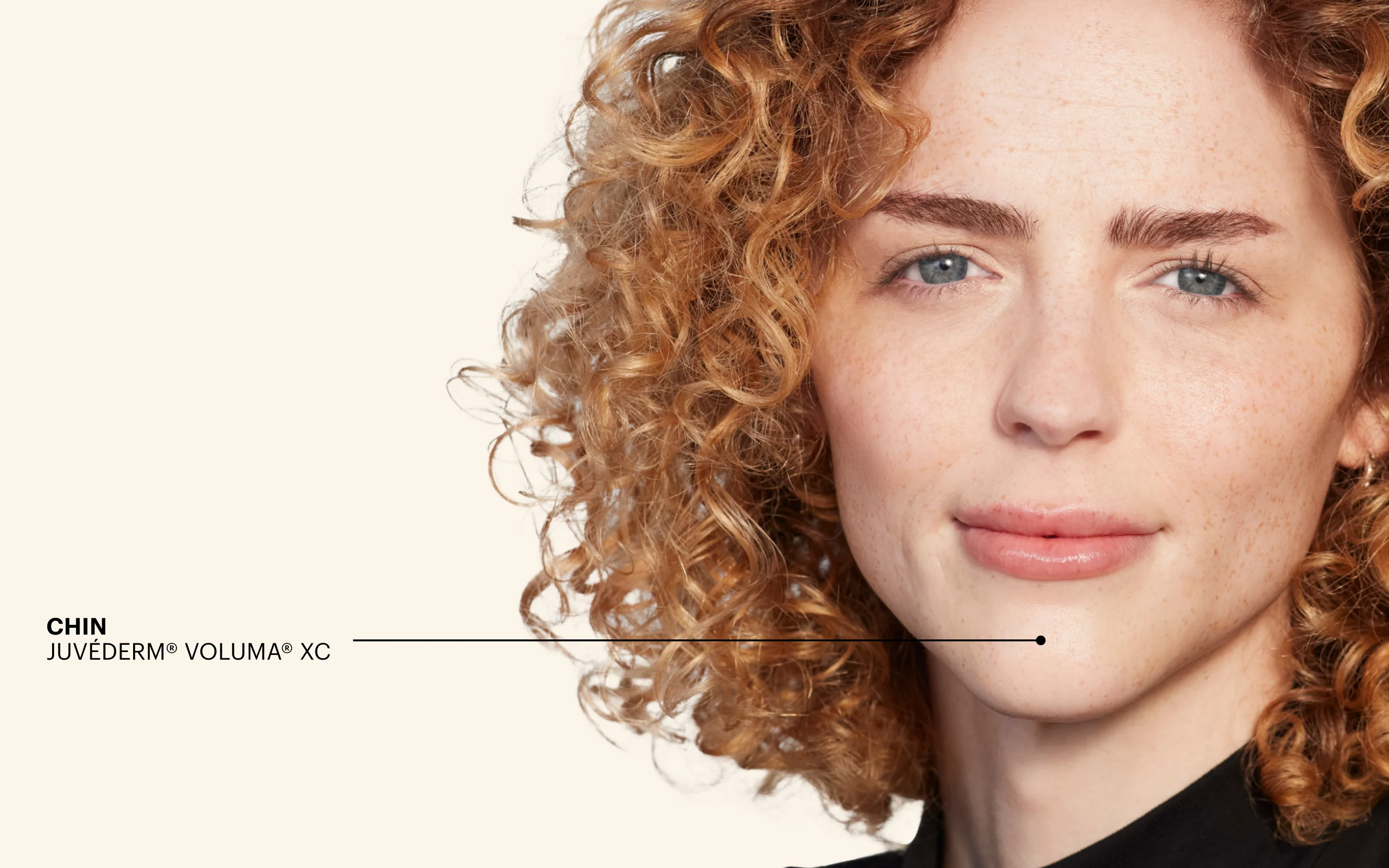 Close-up portrait representing REVIVA's natural, dermal filler results